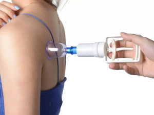 Kineska masaza terapi vakum igle