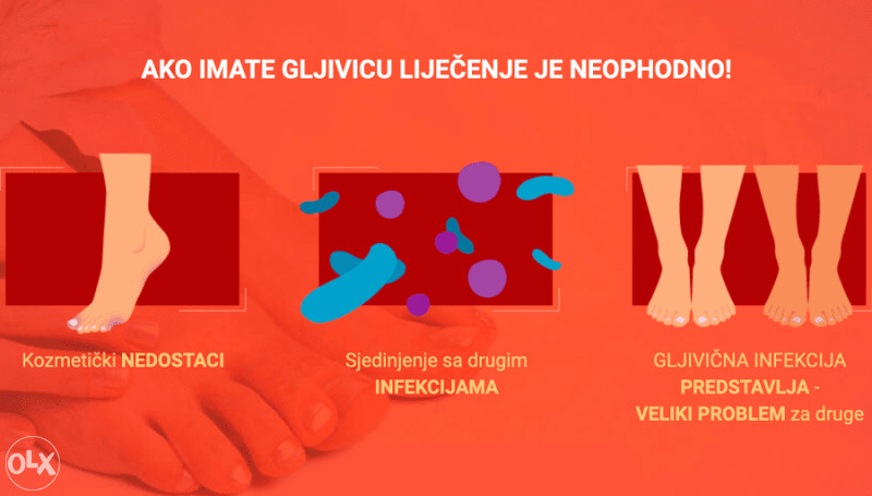 MIKOHERB - KREMA ZA GLJIVICE NA NOGAMA STOPALIMA PRSTIMA