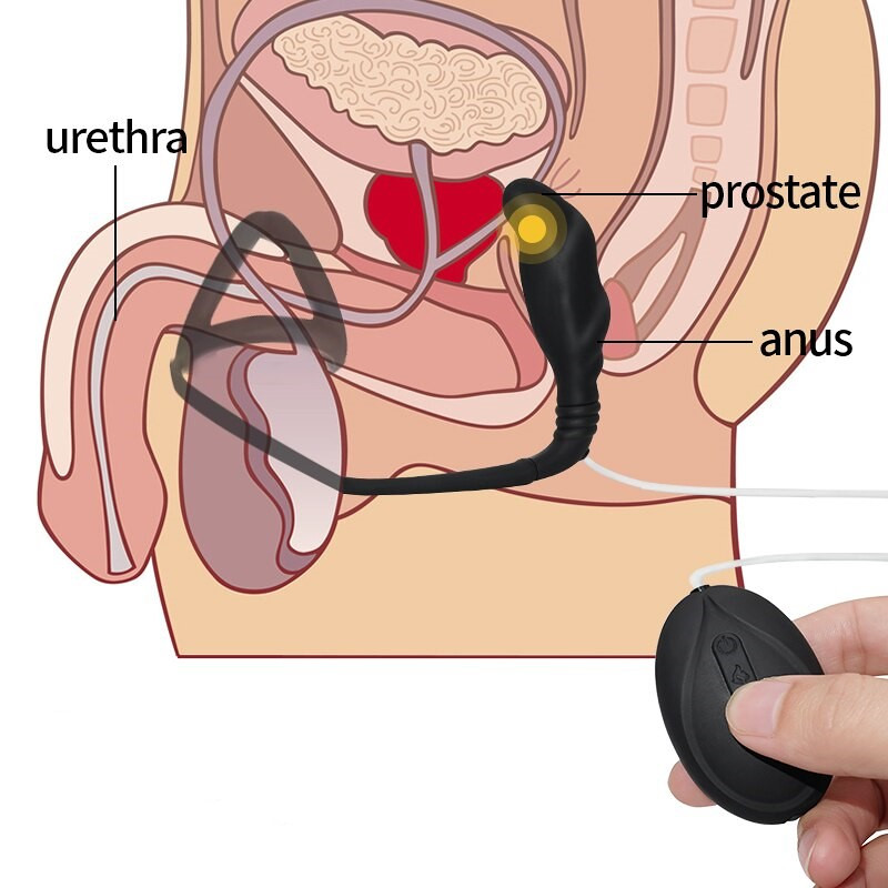 Prsten sa analnim vibratorom/ Seksualna pomagala