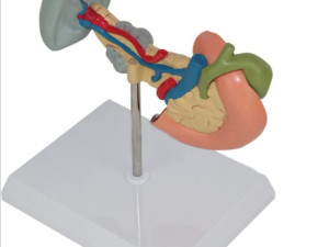 Model pankreas-duodenum-patologija-anatomija