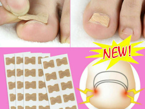 Flasteri 20 kom za urastanje korekcija uraslog nokta