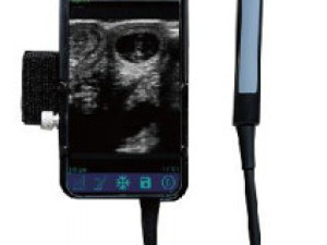 B/W USB ULTRAZVUK,PREKO TELEFONA