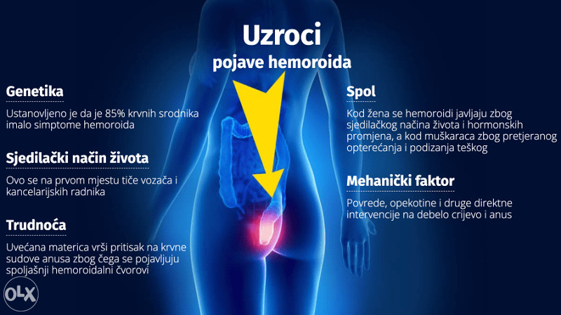 HEMOROCLEAR - KREMA ZA HEMOROIDE MAST PROTIV UPALE ŠULJEVA