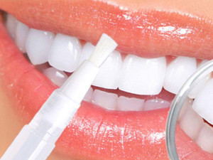 Olovka za izbijeljivanje zuba