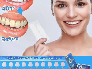 3D trake za izbjeljivanje zuba 1+2 GRATIS