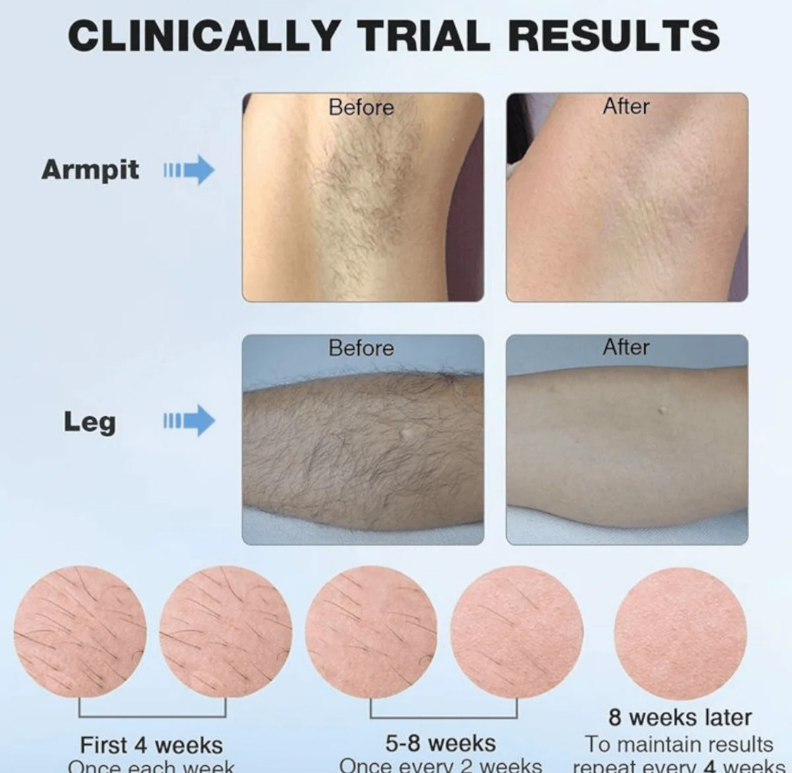 Laserski Epilator ICE EFFECT