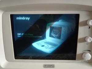 Extra ultrazvuk prenosivi ultrazvučni sistem MINDRAY DP-2200Plus